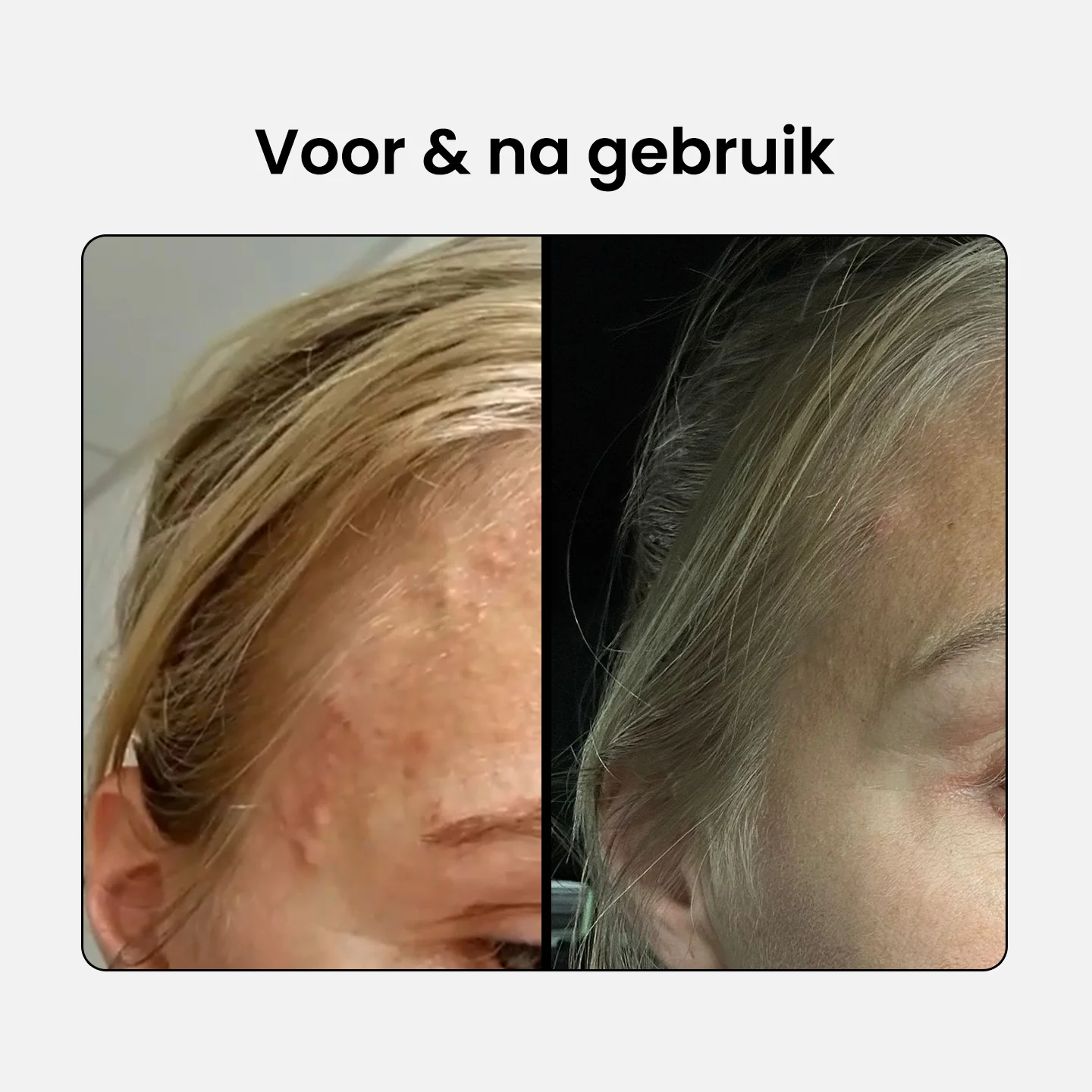 Productafbeelding 4